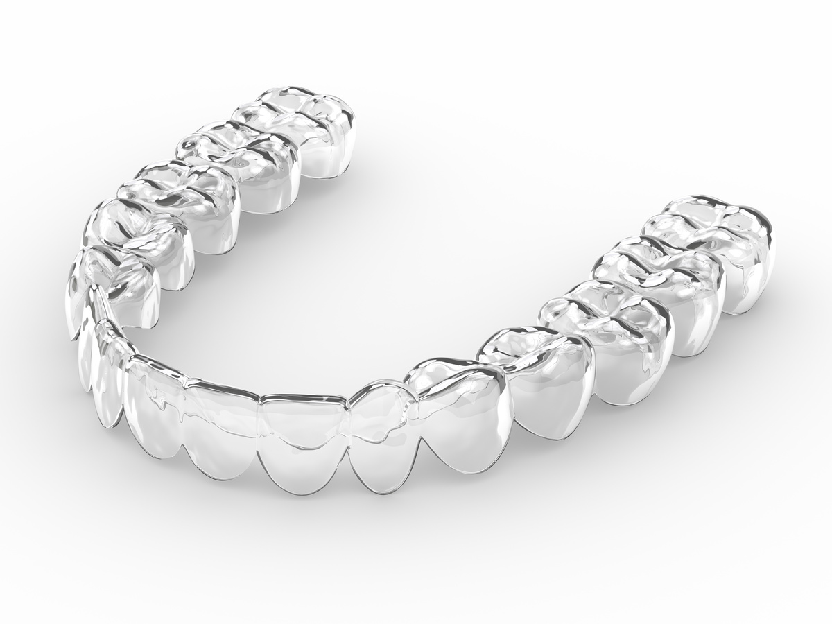 Invisalign for Teens and Adults: Everything You Need to Know Before Making the Investment