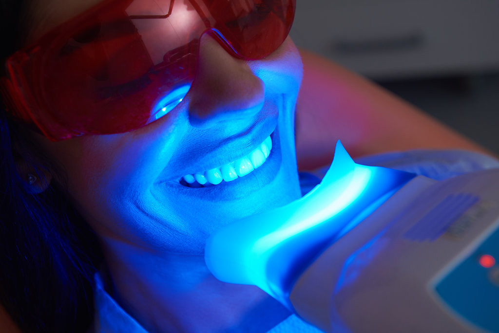 5 Teeth Whitening Myths Debunked